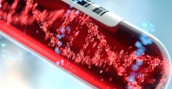 Legături genetice descoperite între rezultatele la testele de sânge și unele boli mintale