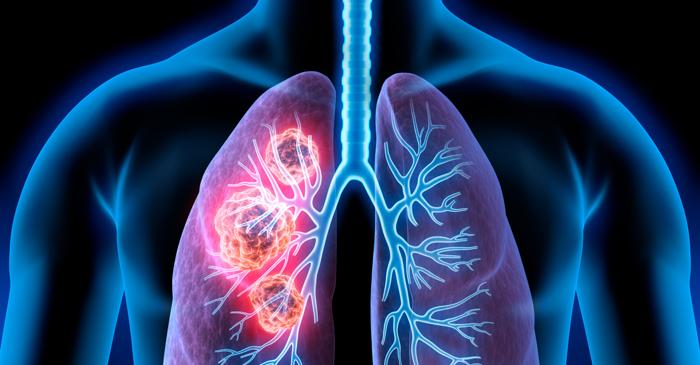 Stresul cronic favorizează răspândirea cancerului: iată cum