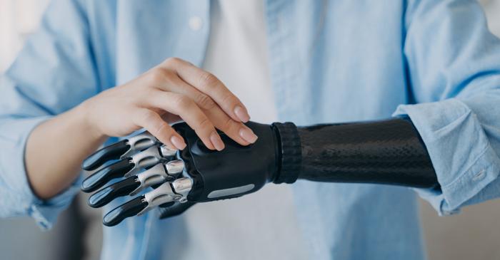 Proteza bionică ce transmite senzații reale a devenit realitate în România