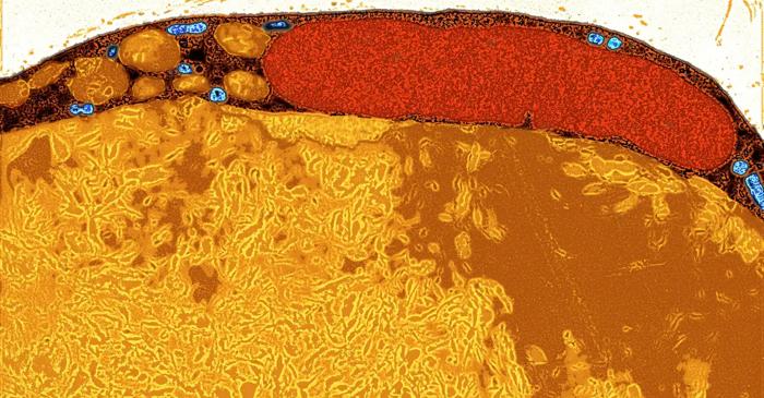 Cercetători americani transformă celulele adipoase în arme împotriva cancerului