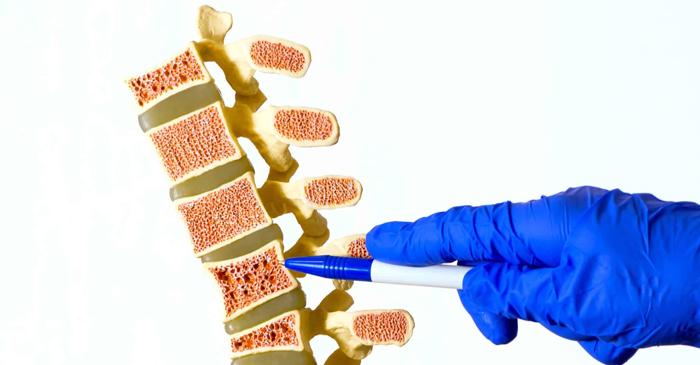 Un receptor celular stimulează refacerea oaselor afectate de osteoporoză
