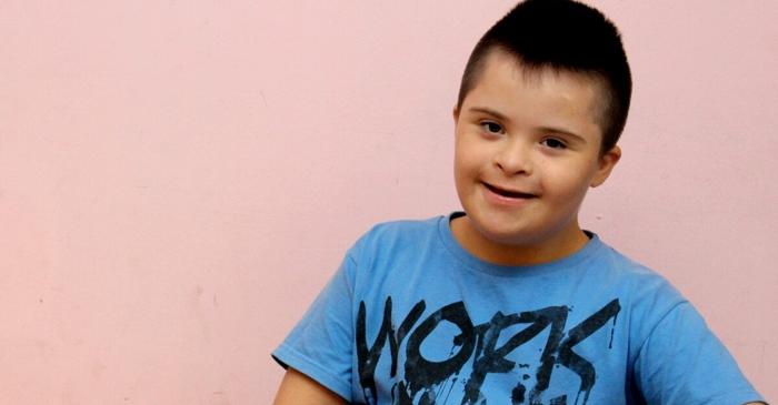 Cercetătorii au dezactivat cromozomul care provoacă sindromul Down