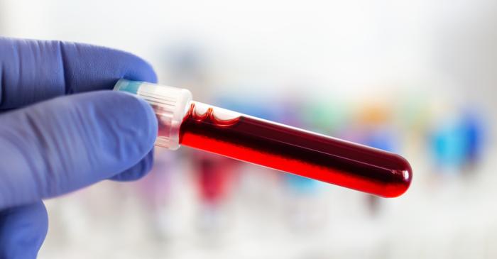 Cererea pentru sânge nevaccinat blochează transfuzii vitale în spitalele din Statele Unite