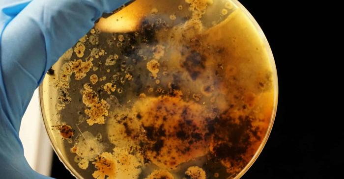 Un nucleozid din corp face bacteriile rezistente să devină din nou sensibile la antibiotice