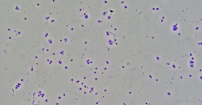 Un parazit microscopique îmbunătățește atracția fizică la jumătate din omenire