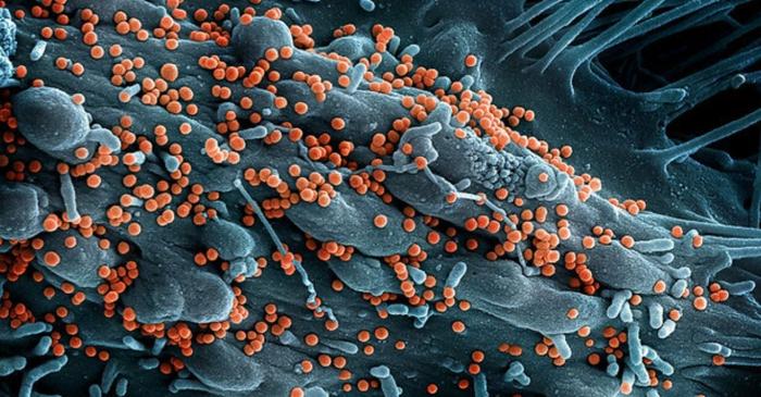 Virusul Lujo, cu o rată de mortalitate de 80%, a provocat o singură epidemie